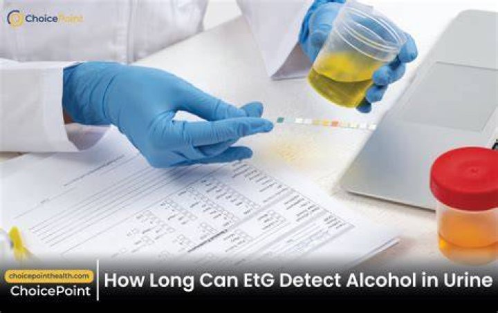 How far back can an EtG test detect alcohol?