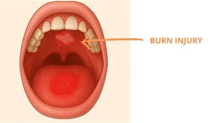 How hot can your mouth handle?