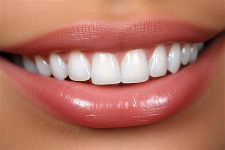How important is white teeth?