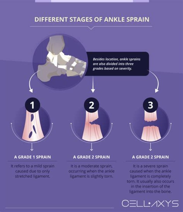 How long can a foot sprain last?