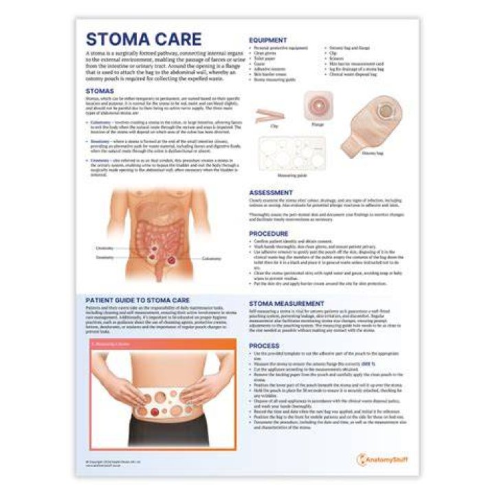 How long can you leave a stoma uncovered?