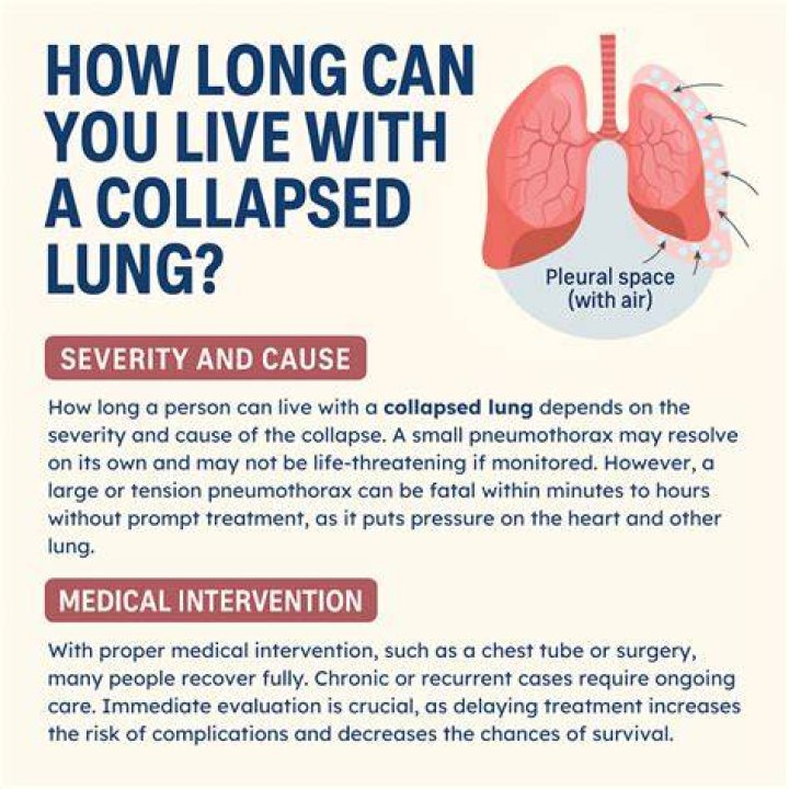 How long can you live on 250k?