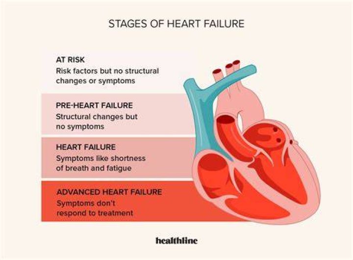 How long can you live with untreated heart failure?