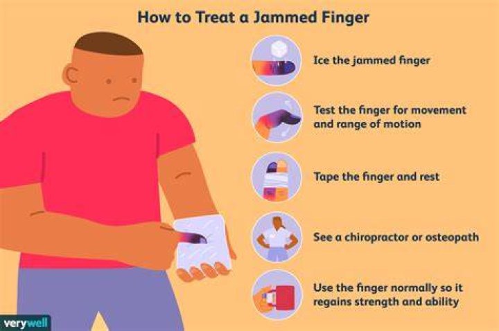 How long does a jammed finger last?