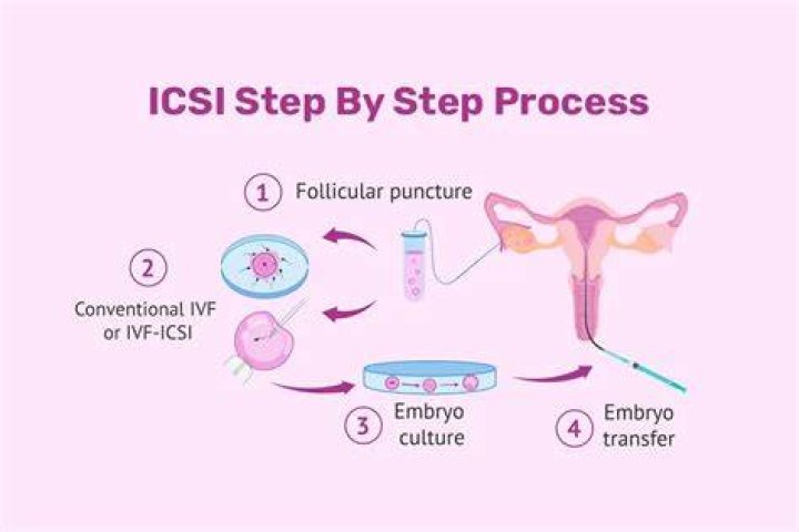 How long does ICSI IVF treatment take?