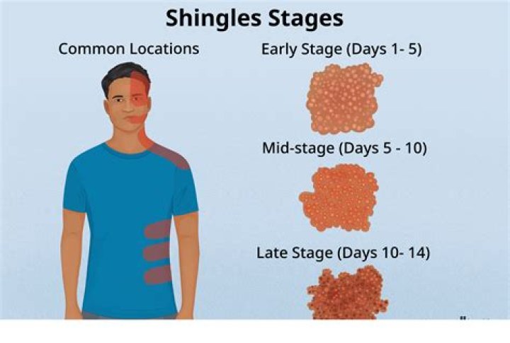 How long does it take for an infection to start?