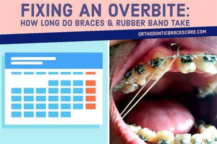 How long does it take for rubber bands on braces to stop hurting?