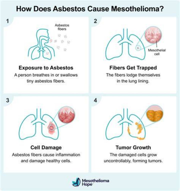 How long does it take to die from mesothelioma?