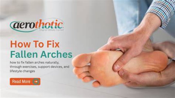 How long does it take to fix fallen arches?