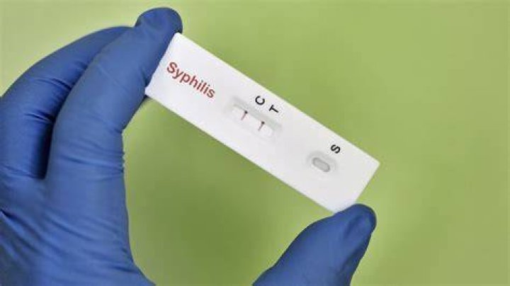 How long does it take to test positive for syphilis?