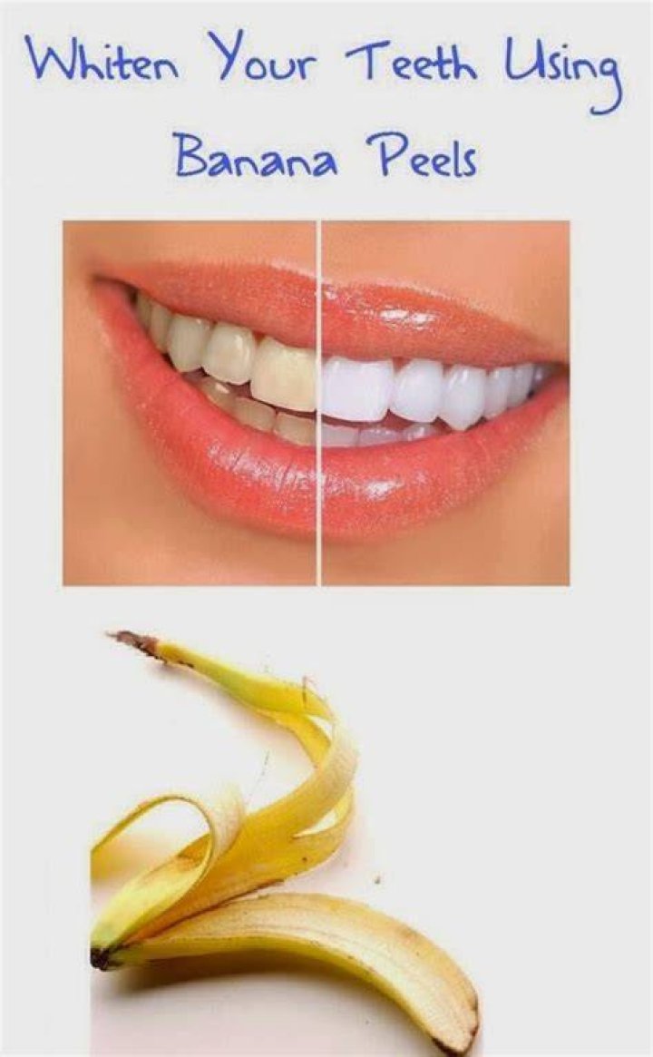 How long does it take to whiten teeth with banana peel?
