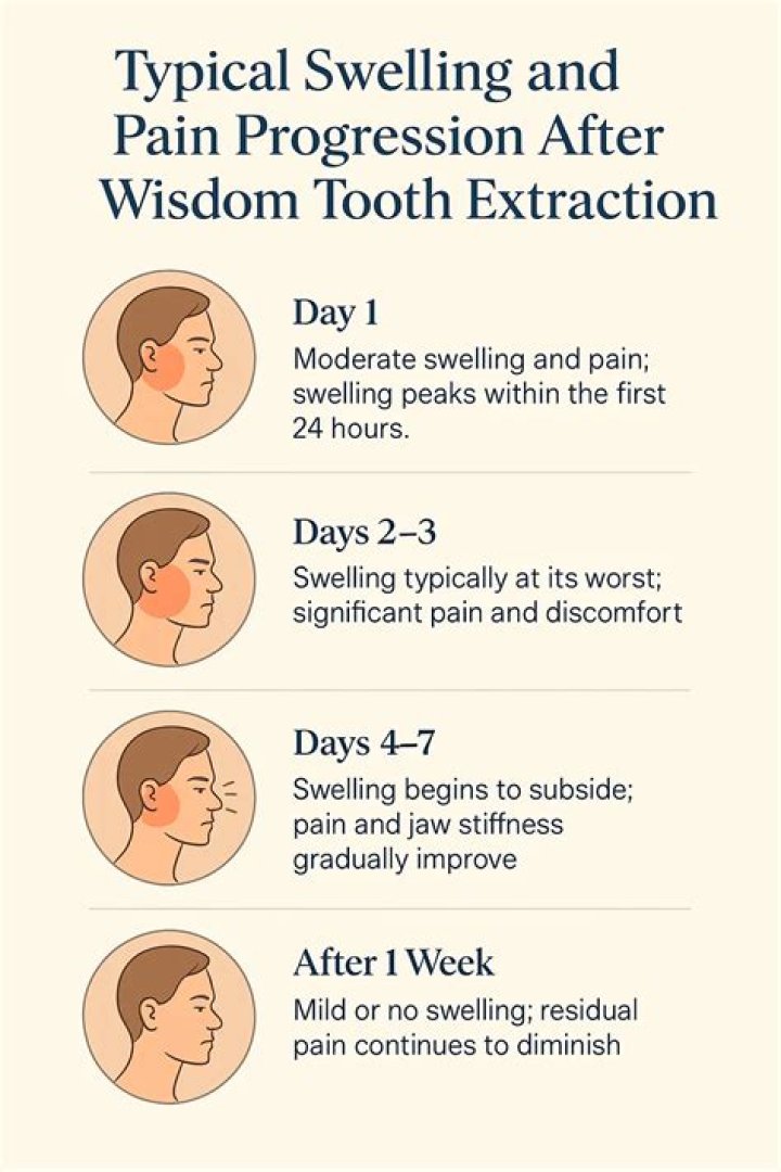 How long does jaw pain last after tooth extraction?