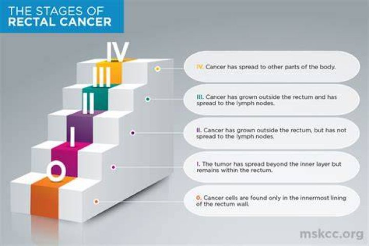 How long does rectal cancer take to kill?