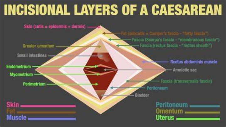 How many layers of skin is cut during C-section?