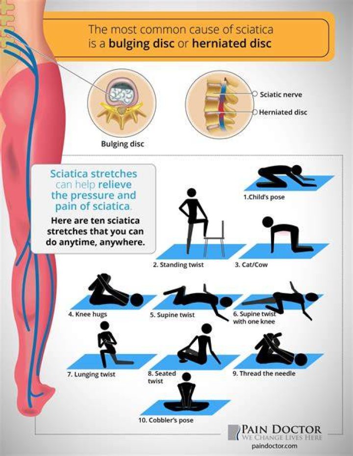 How many times a day should you do sciatica exercises?