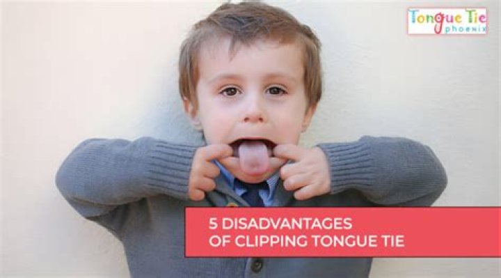 How much does it cost to get your tongue clipped?