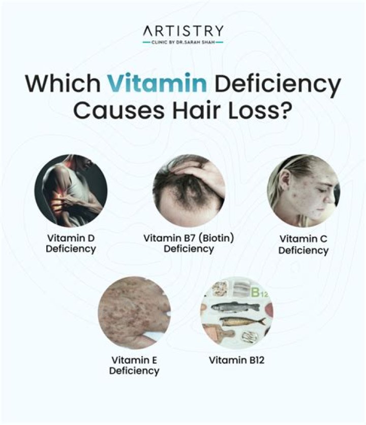 How much vitamin A causes hairloss?