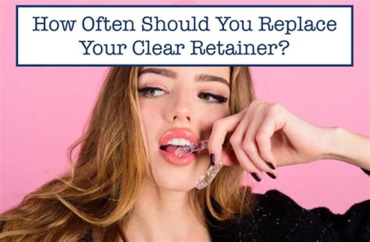 How often should I change retainers?