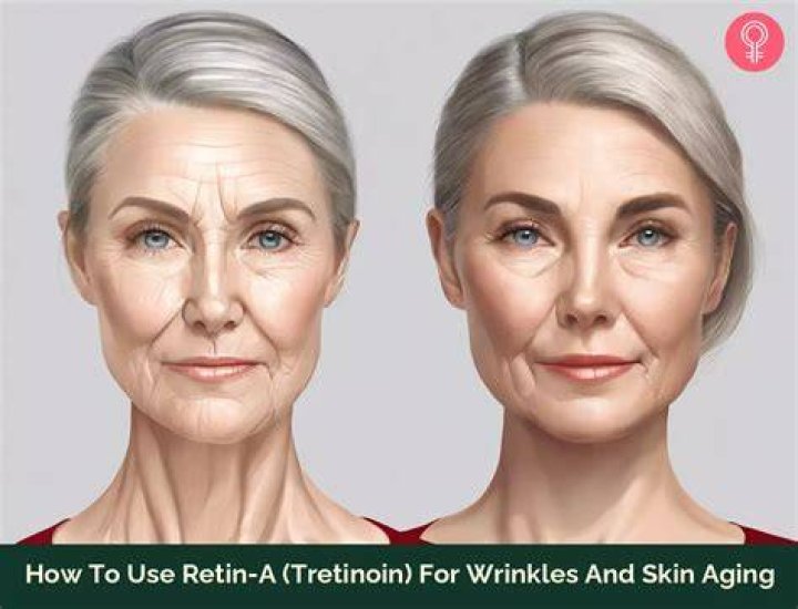How often should I use Retin A for wrinkles?