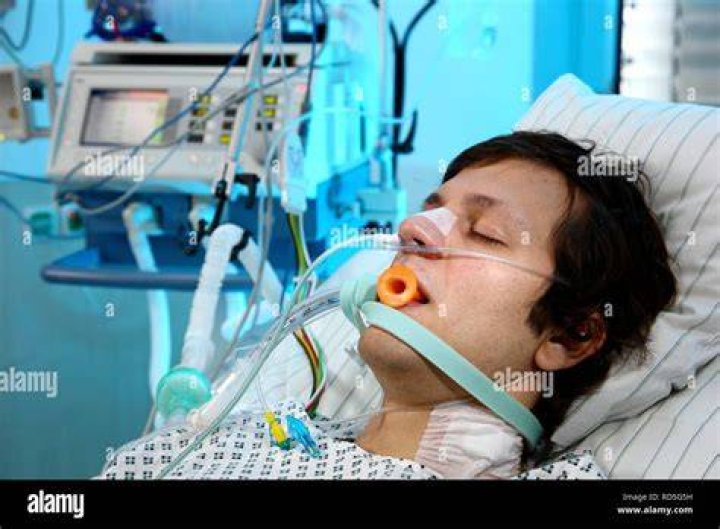 How painful is being intubated?