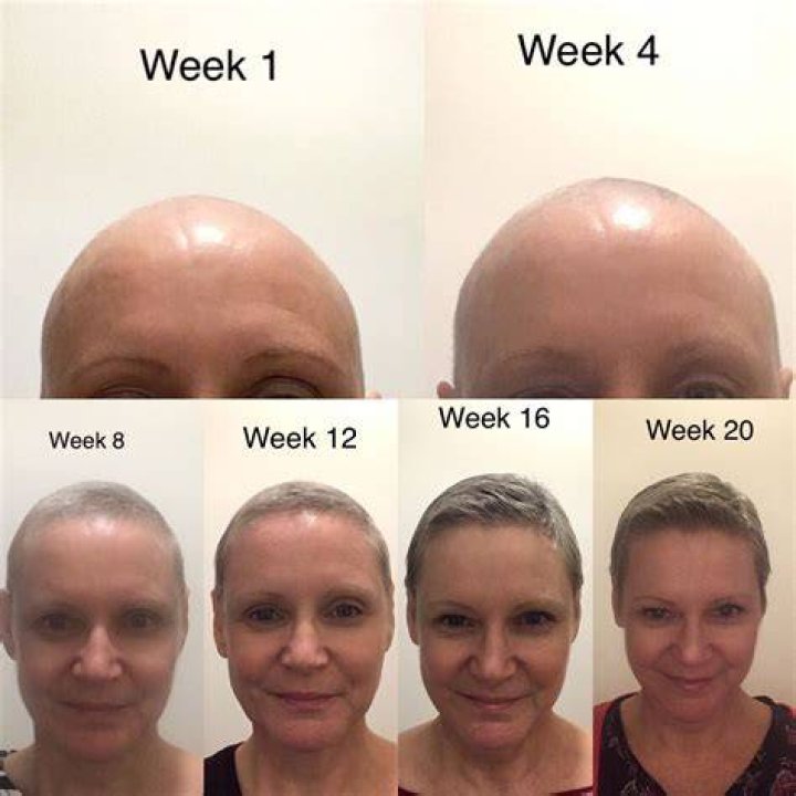 How quickly does hair grow after chemo?