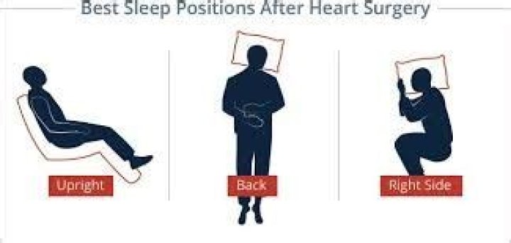 How should you sleep after heart surgery?