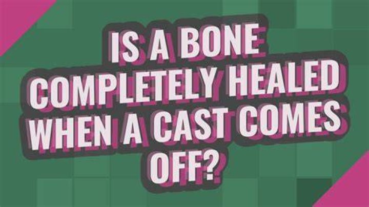 Is a bone completely healed when a cast comes off?