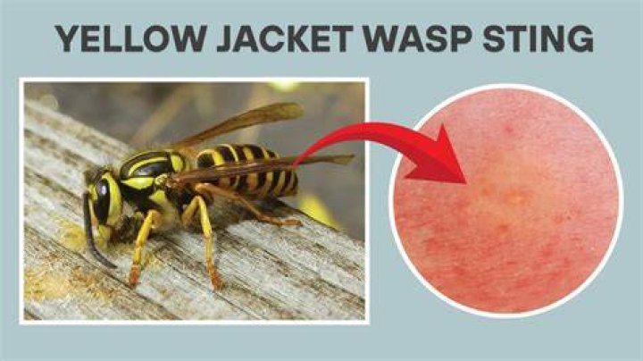 Is a yellow jacket sting worse than a wasp?
