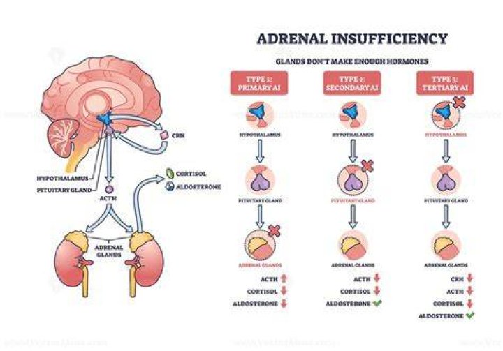 Is adrenal insufficiency life threatening?