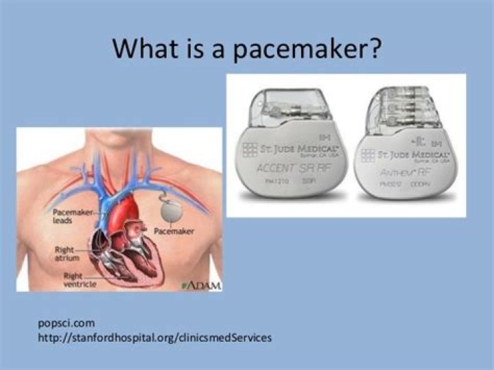 Is an ICD heart starter the same as a pacemaker?
