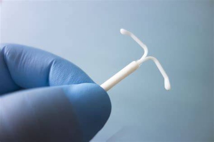 Is an IUD worth it?