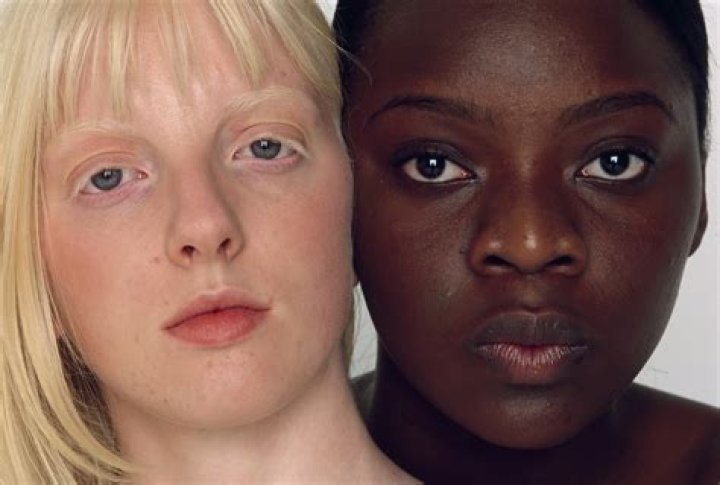 Is black skin drier than white skin?