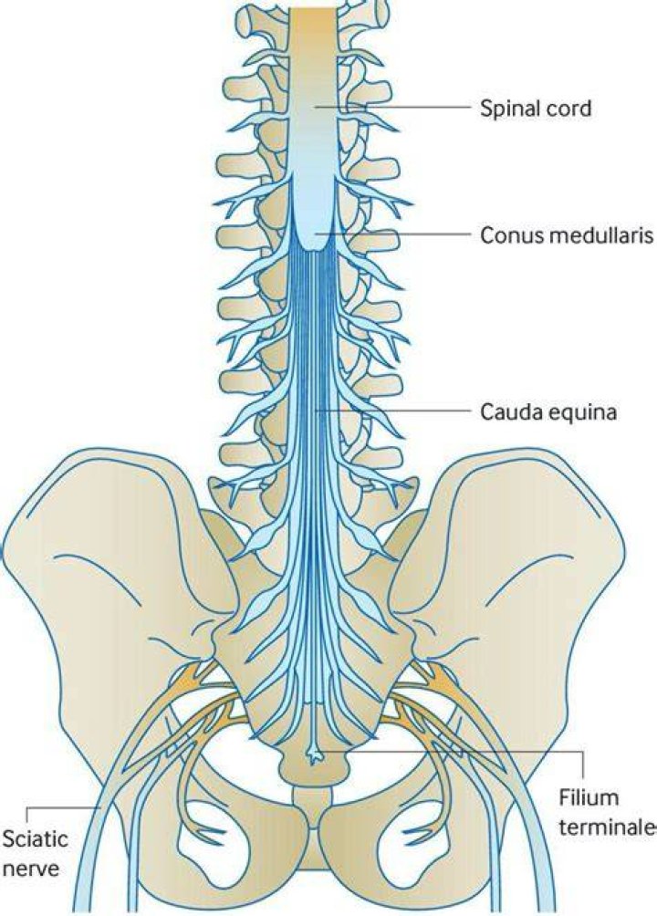 Is cauda equina an emergency?