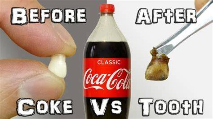 Is Coke worse for your teeth?