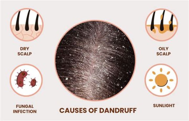 Is dandruff a problem?