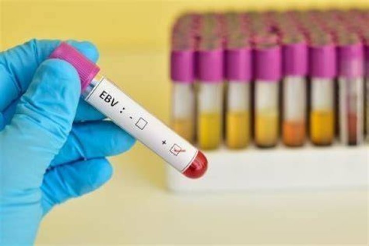 Is EBV a disability?