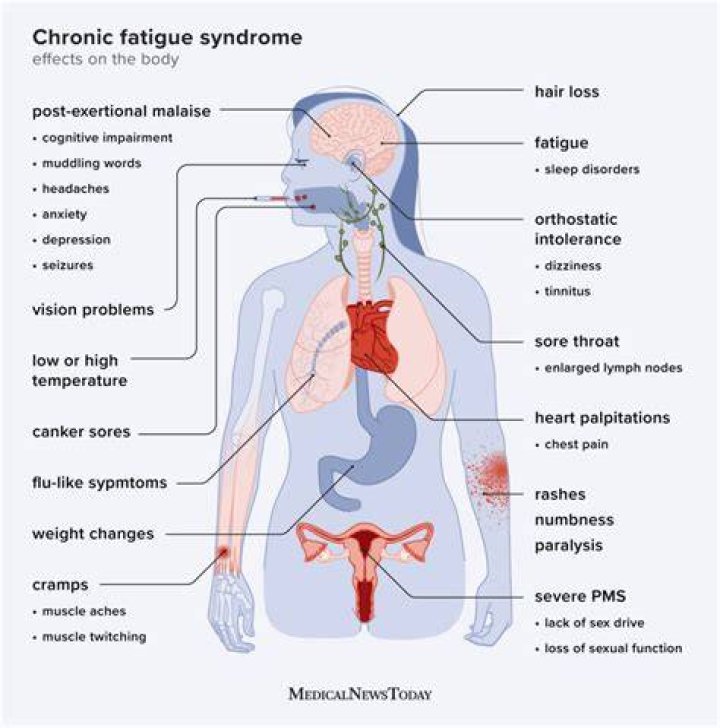 Is fatigue a neurological symptom?