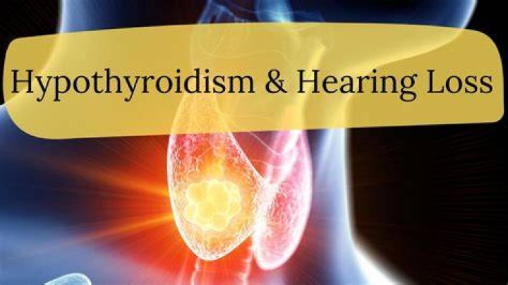 Is hearing loss due to hypothyroidism reversible?