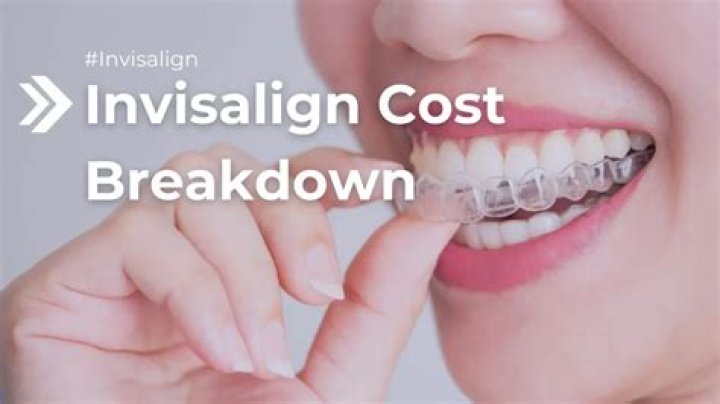 Is Invisalign worth the cost?