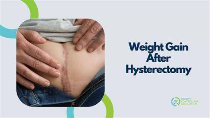 Is it common to gain weight after hysterectomy?