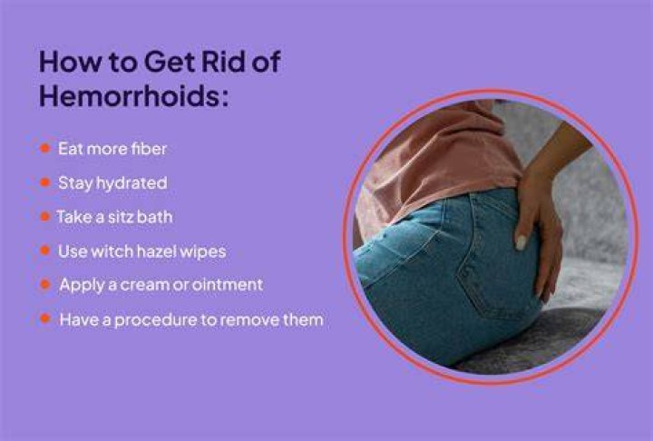 Is it OK to ice a hemorrhoid?
