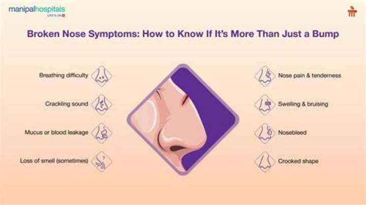 Is it OK to swim with a broken nose?
