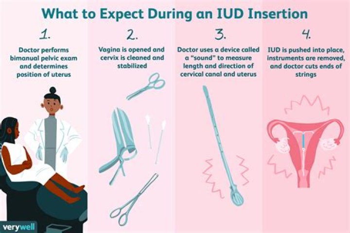 Is IUD insertion painful?