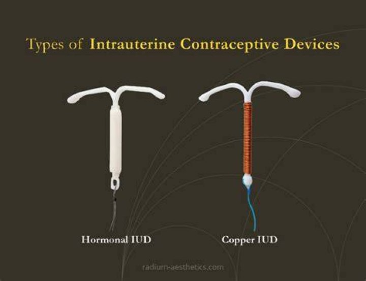 Is IUD The best contraceptive?