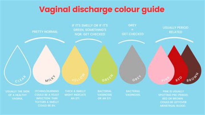 Is light yellow discharge normal?