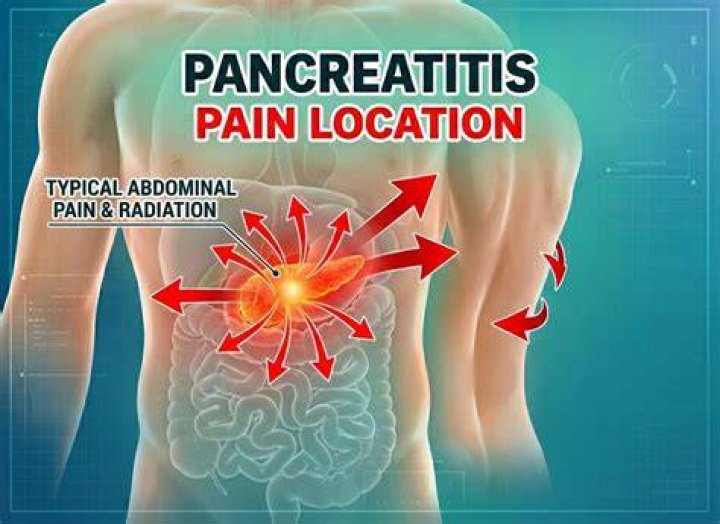 Is pancreatitis pain on left or right?