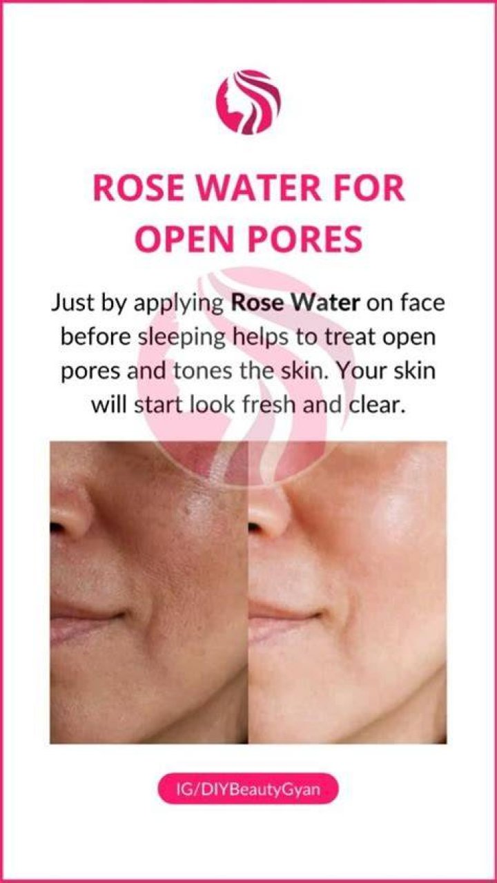 Is Rose water good for open pores?