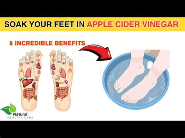 Is soaking your feet in vinegar good for you?