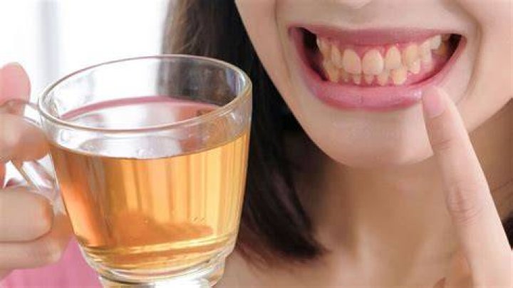 Is tea bad for your teeth?