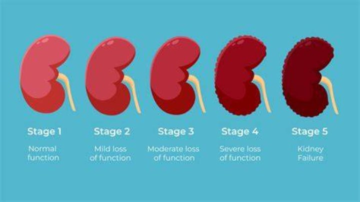 Is there a Stage 6 kidney failure?
